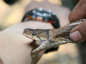 网友爆料被蛇咬了视频,紧急救援！网友现场直击蛇咬事件